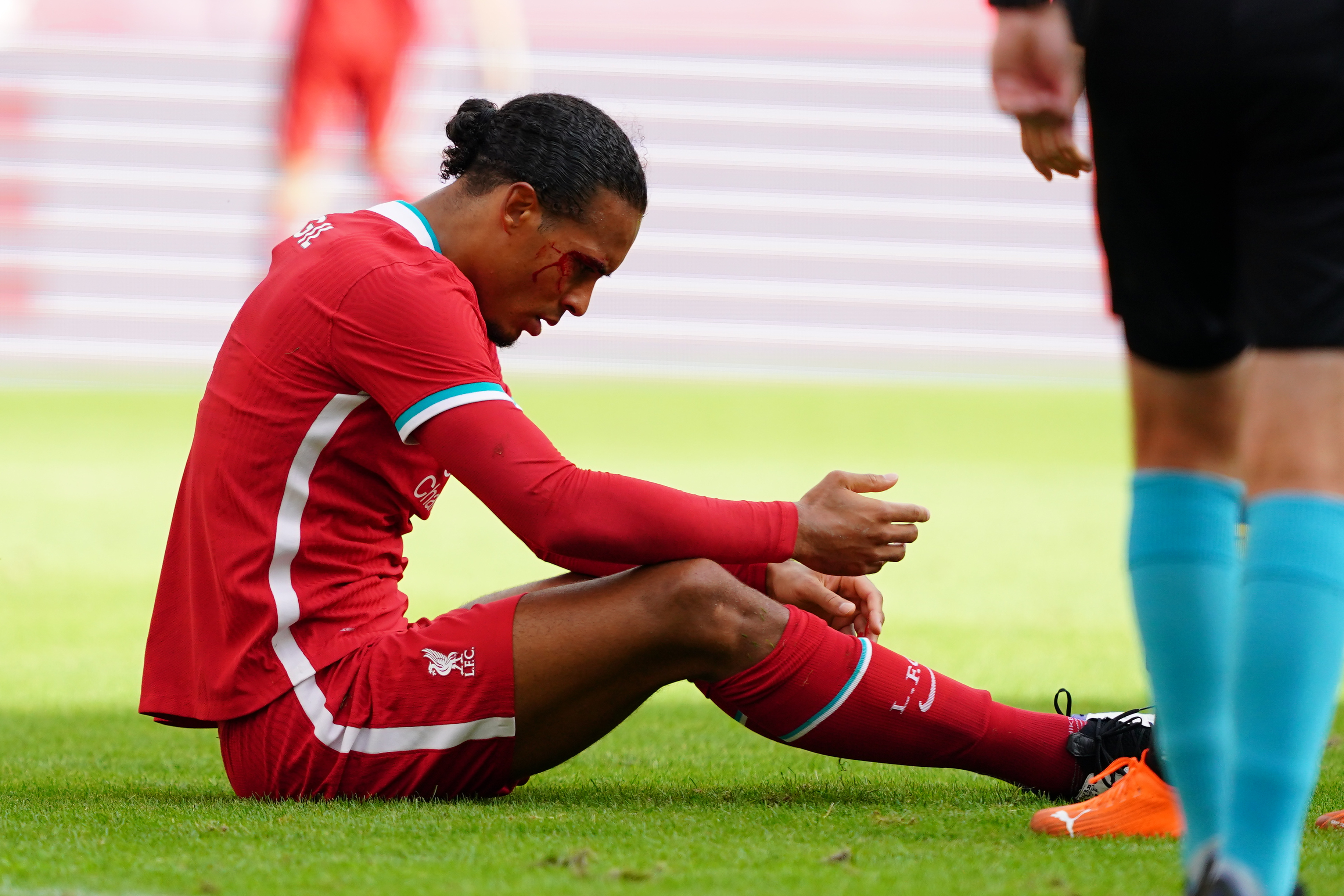 STYGT KUTT: Virgil van Dijk måtte forlate banen mens blodet rant fra et kutt ved høyre øye.